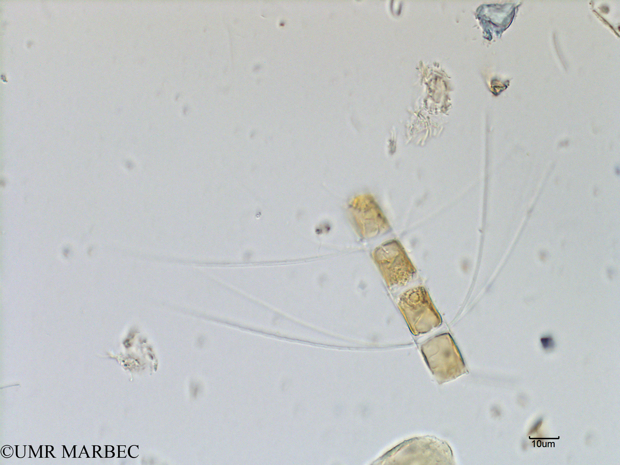 phyto/Scattered_Islands/mayotte_lagoon/SIREME May 2016/Chaetoceros sp34 (MAY5_cf chaetoceros sp -9).tif(copy).jpg